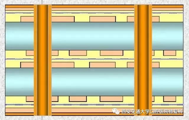 PCB鉆孔示意圖